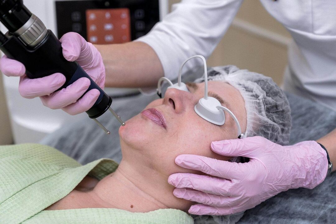 Laser ablative skin rejuvenation procedure