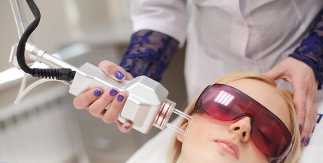 Facial rejuvenation principle of laser