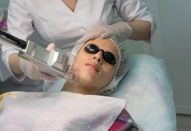 Laser rejuvenation of the field